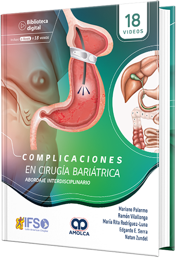 Complicaciones en Cirugía Bariátrica. Abordaje interdisciplinario.