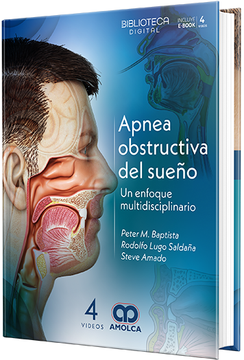 Apnea obstructiva del sueño. Un enfoque multidisciplinario