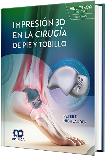 Impresión 3D en la cirugía de pie y tobillo