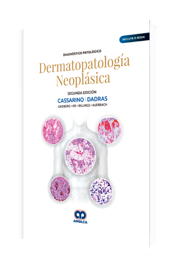 Diagnóstico Patológico Dermatopatología Neoplásica 2 Edición