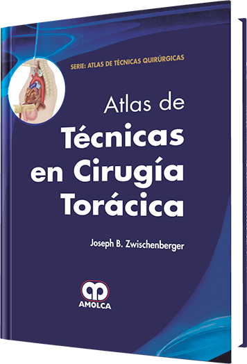 Atlas de Técnicas en Cirugía Torácica