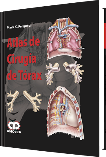 Atlas de Cirugía de Tórax