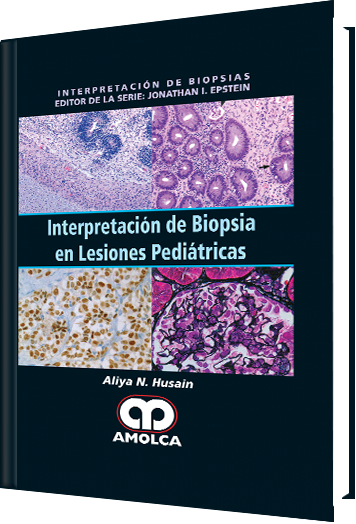 Interpretación de Biopsia en Lesiones Pediátricas