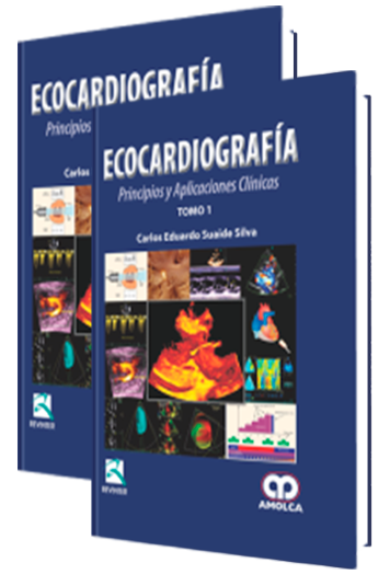 Ecocardiografía Principios y Aplicaciones Clínicas