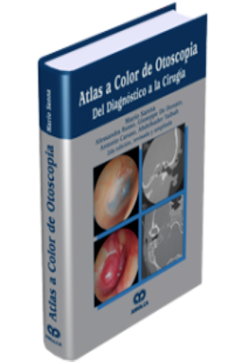 Atlas a Color de Otoscopia